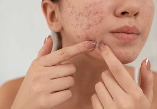 how your gut health affects the skin